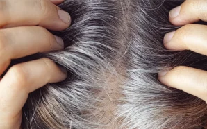 Який вітамін потрібно приймати, щоб зменшити сивину у волоссі