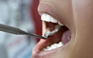огляд ротової порожнини стоматологом